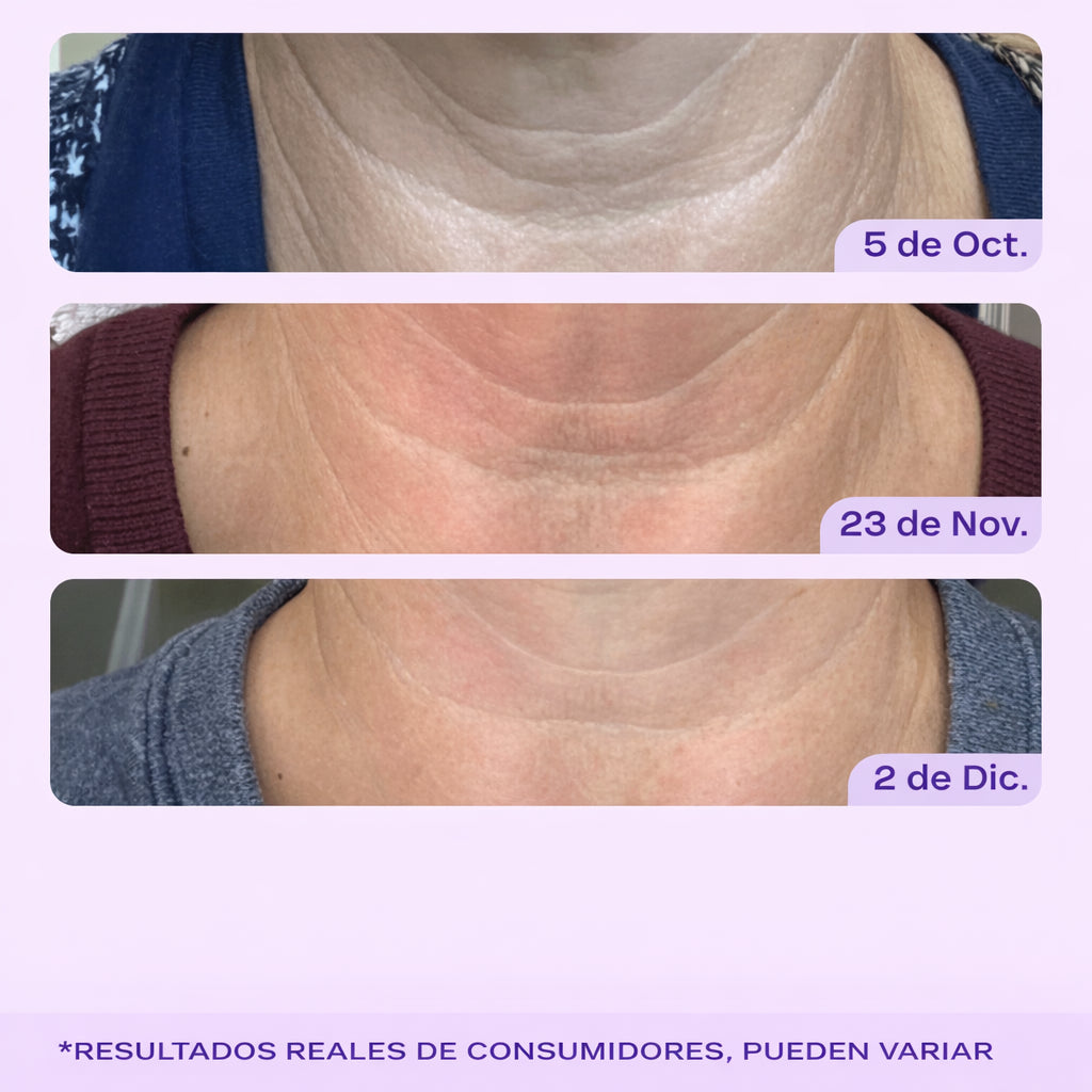 GoPure Crema para apretar y levantar el cuello, clínicamente probada