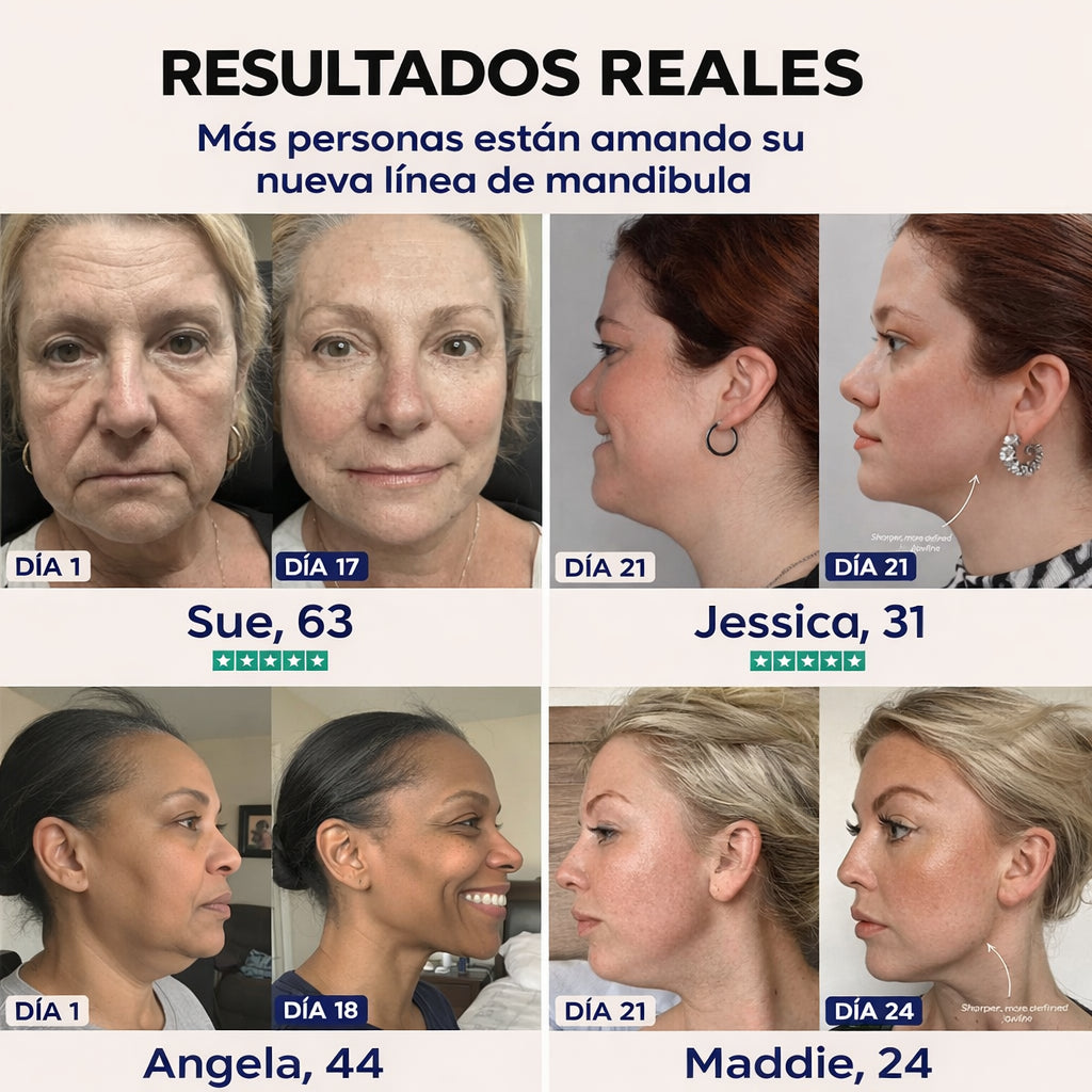 El lifting Chinology™: vuelve a ser la mujer que ama su mandíbula.