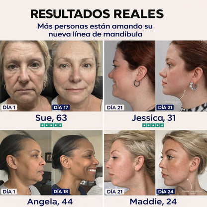 El lifting Chinology™: vuelve a ser la mujer que ama su mandíbula.