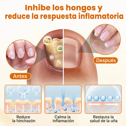 FungiBee™ –Aerosol Cuidado Intensivo para Uñas Maltratadas