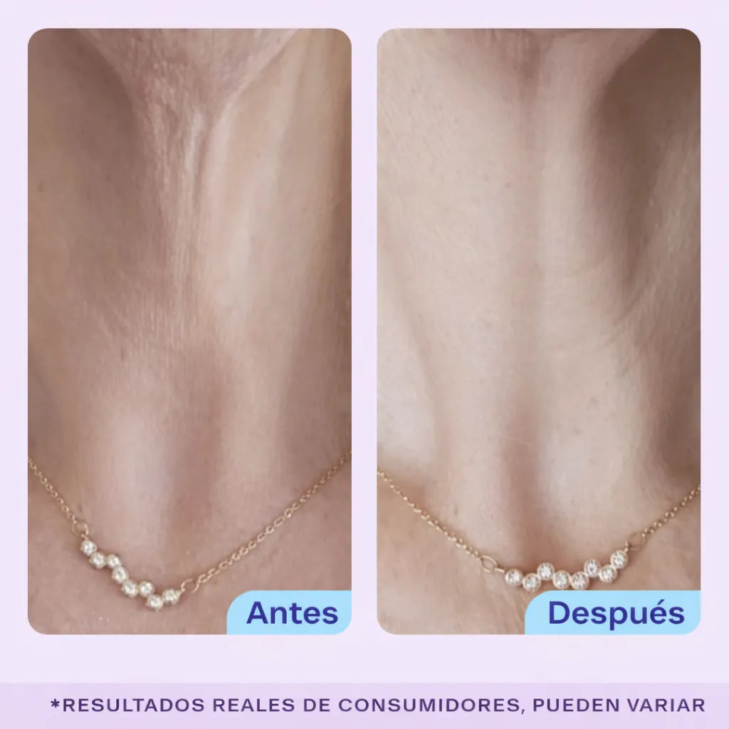 GoPure Crema para apretar y levantar el cuello, clínicamente probada