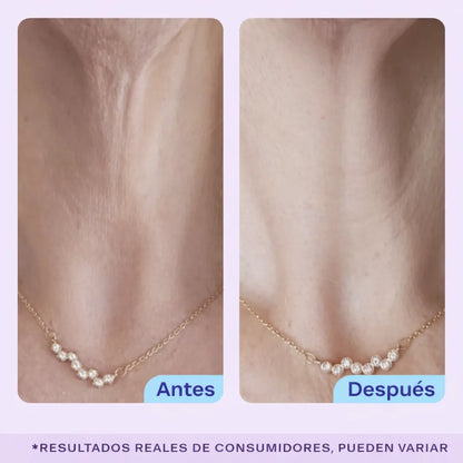 GoPure Crema para apretar y levantar el cuello, clínicamente probada