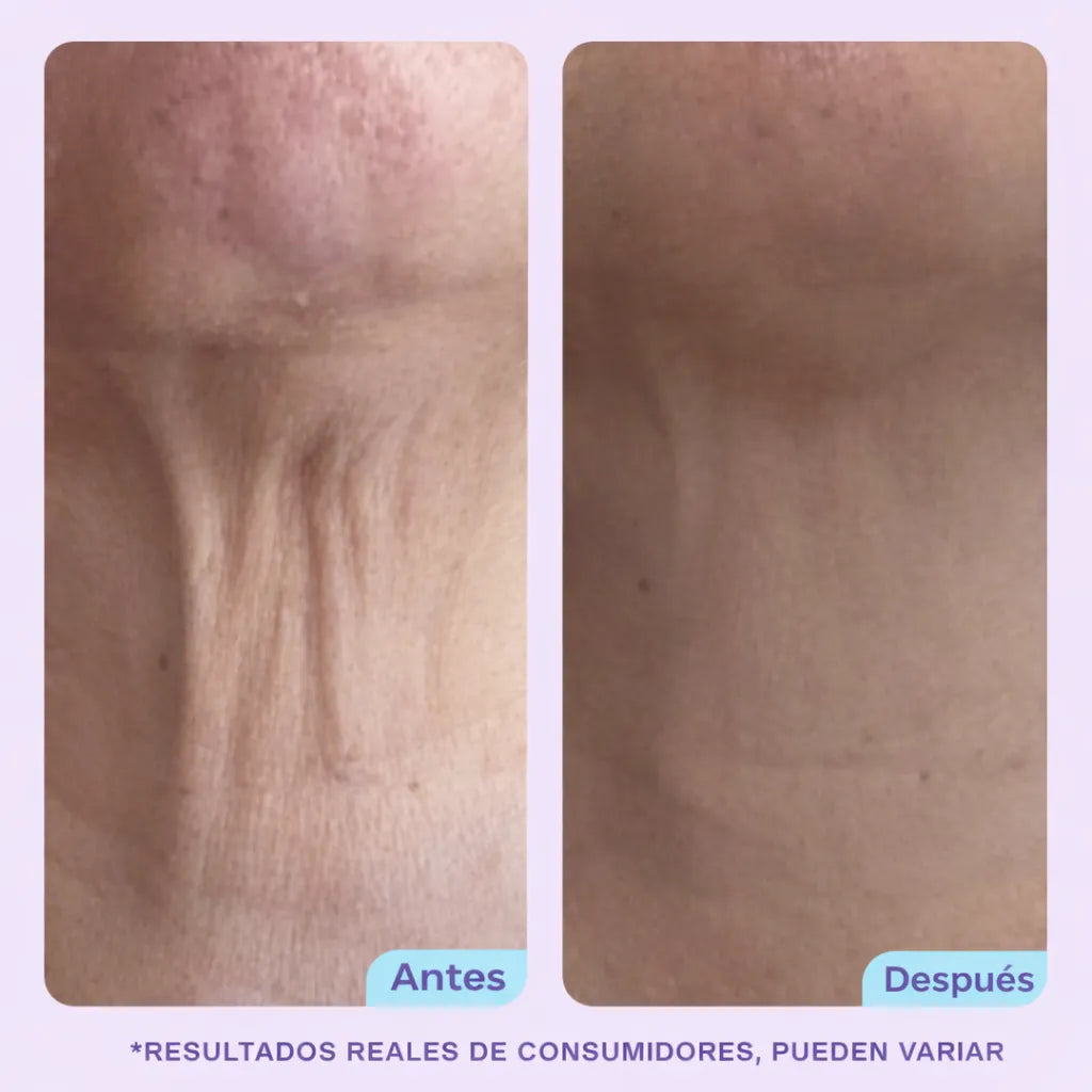 GoPure Crema para apretar y levantar el cuello, clínicamente probada