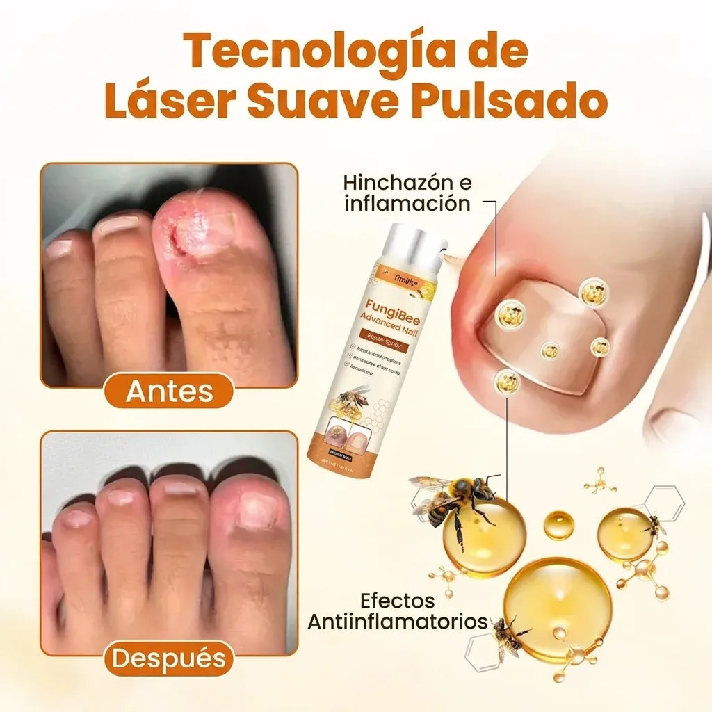 FungiBee™ –Aerosol Cuidado Intensivo para Uñas Maltratadas