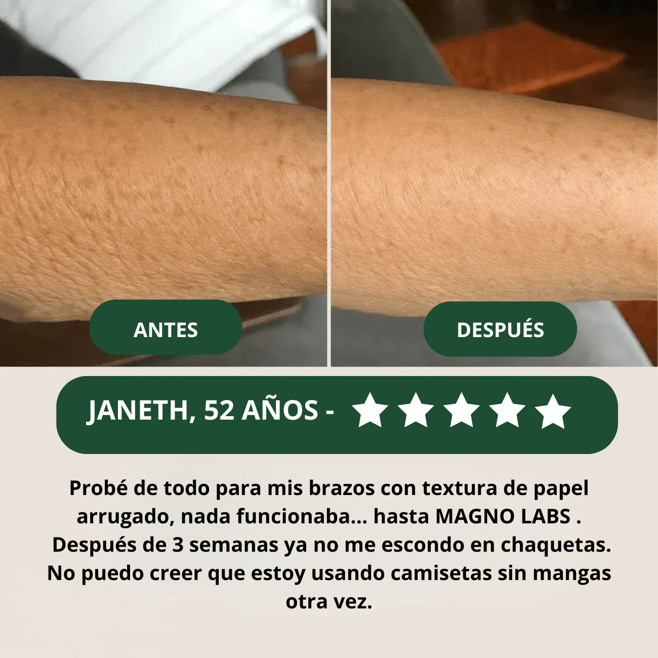 Crema reparadora para piel crepey