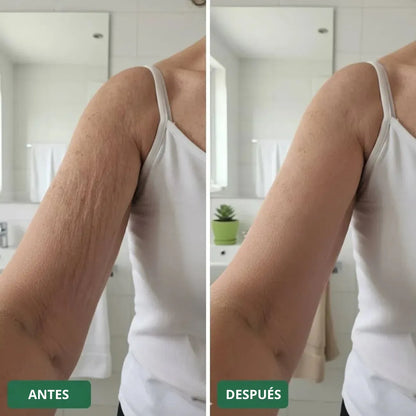 Crema reparadora para piel crepey