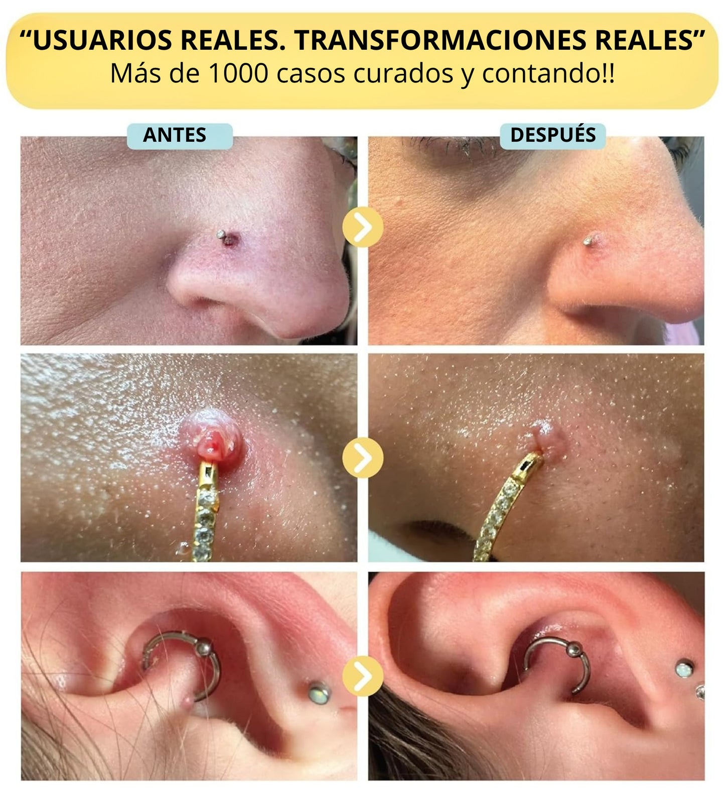 Sistema BUMP de limpieza total para orejas y perforaciones. 2 x 1